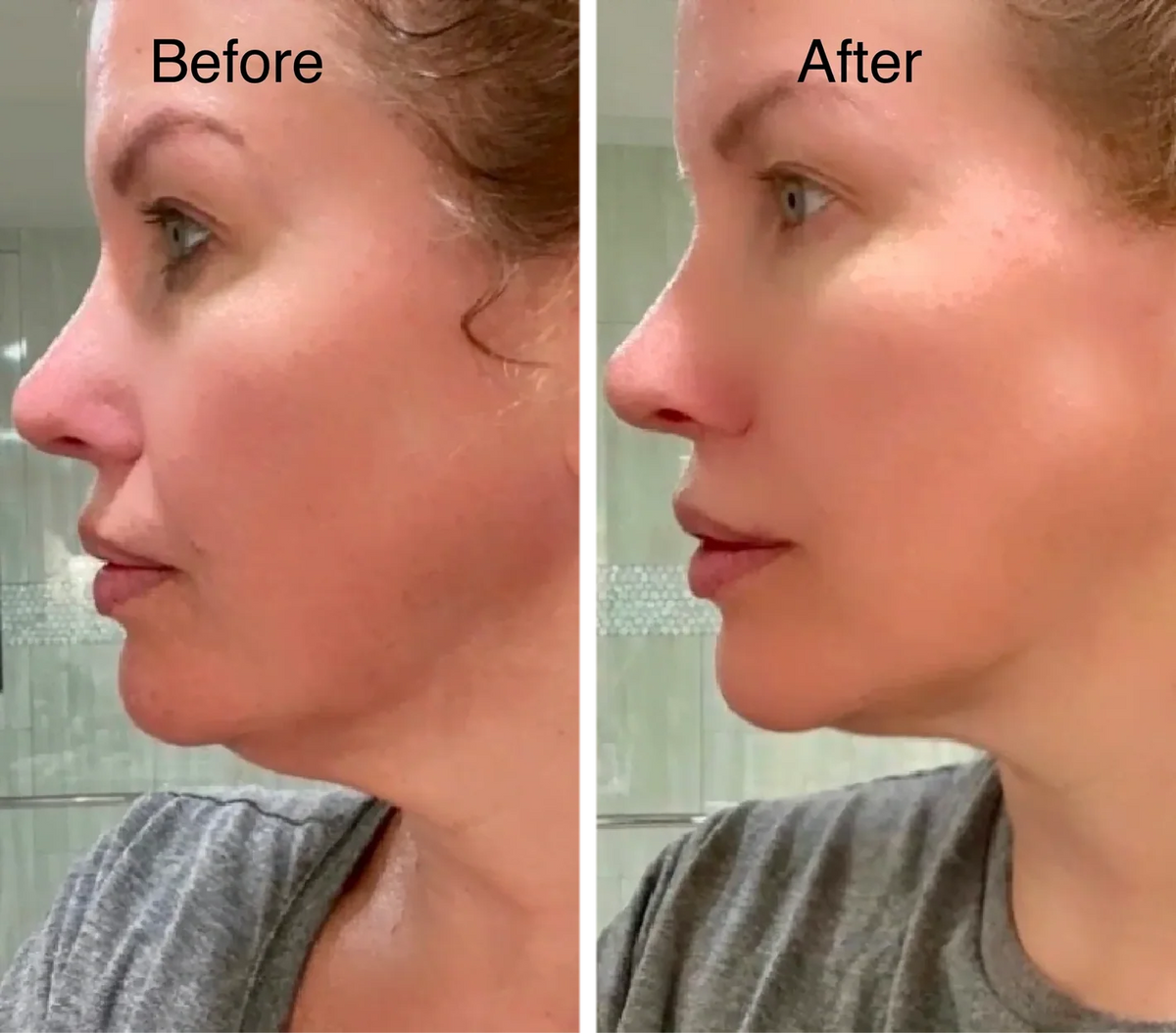Velora Lymphatic Face Brush