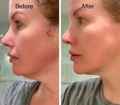 Velora Lymphatic Face Brush