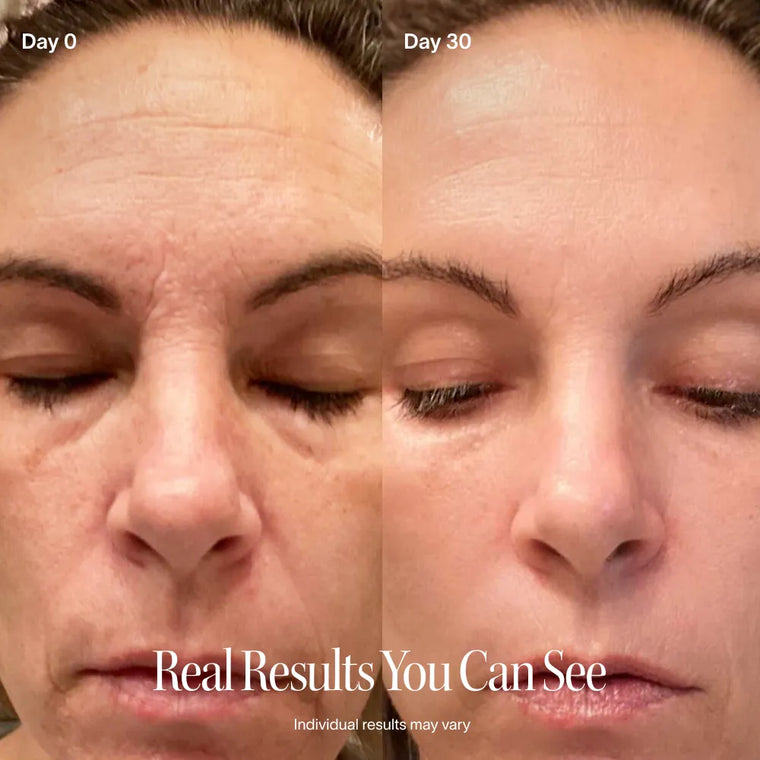 4-in-1 Red Light Therapy Skincare Wand