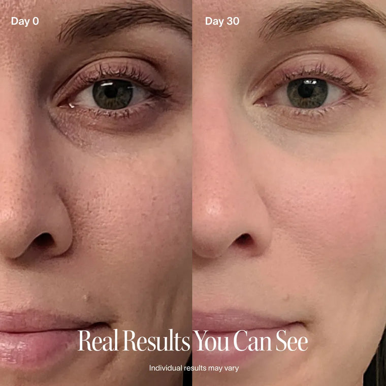 4-in-1 Red Light Therapy Skincare Wand