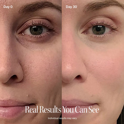 4-in-1 Red Light Therapy Skincare Wand