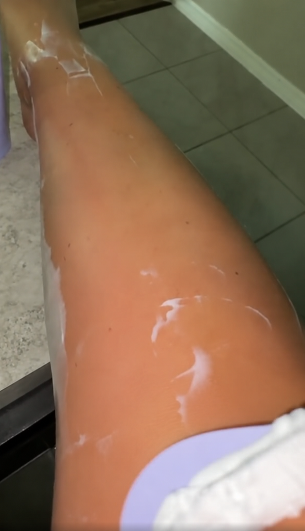 Legs after