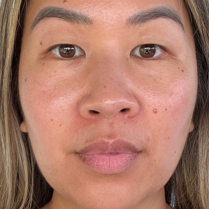After skincare result