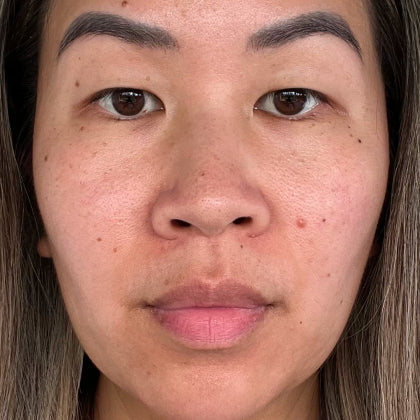 Before skincare result