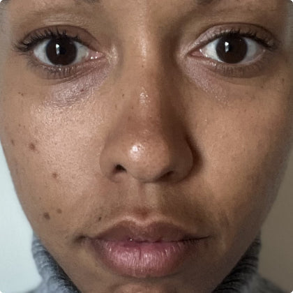 After skincare result