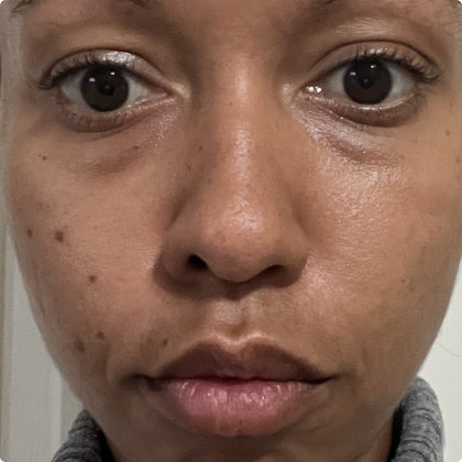 Before skincare result