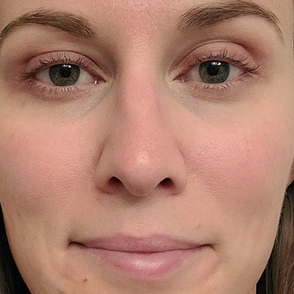 After skincare result