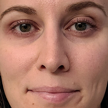 Before skincare result