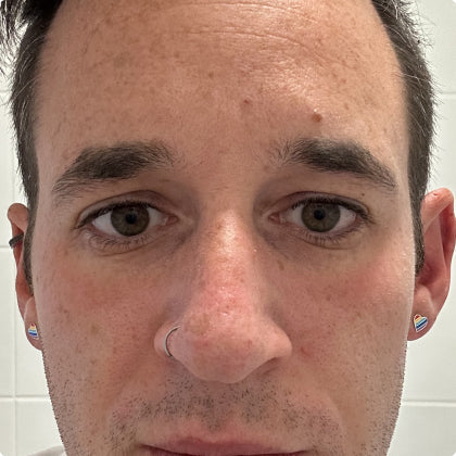 After skincare result