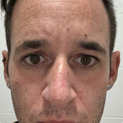 Before skincare result